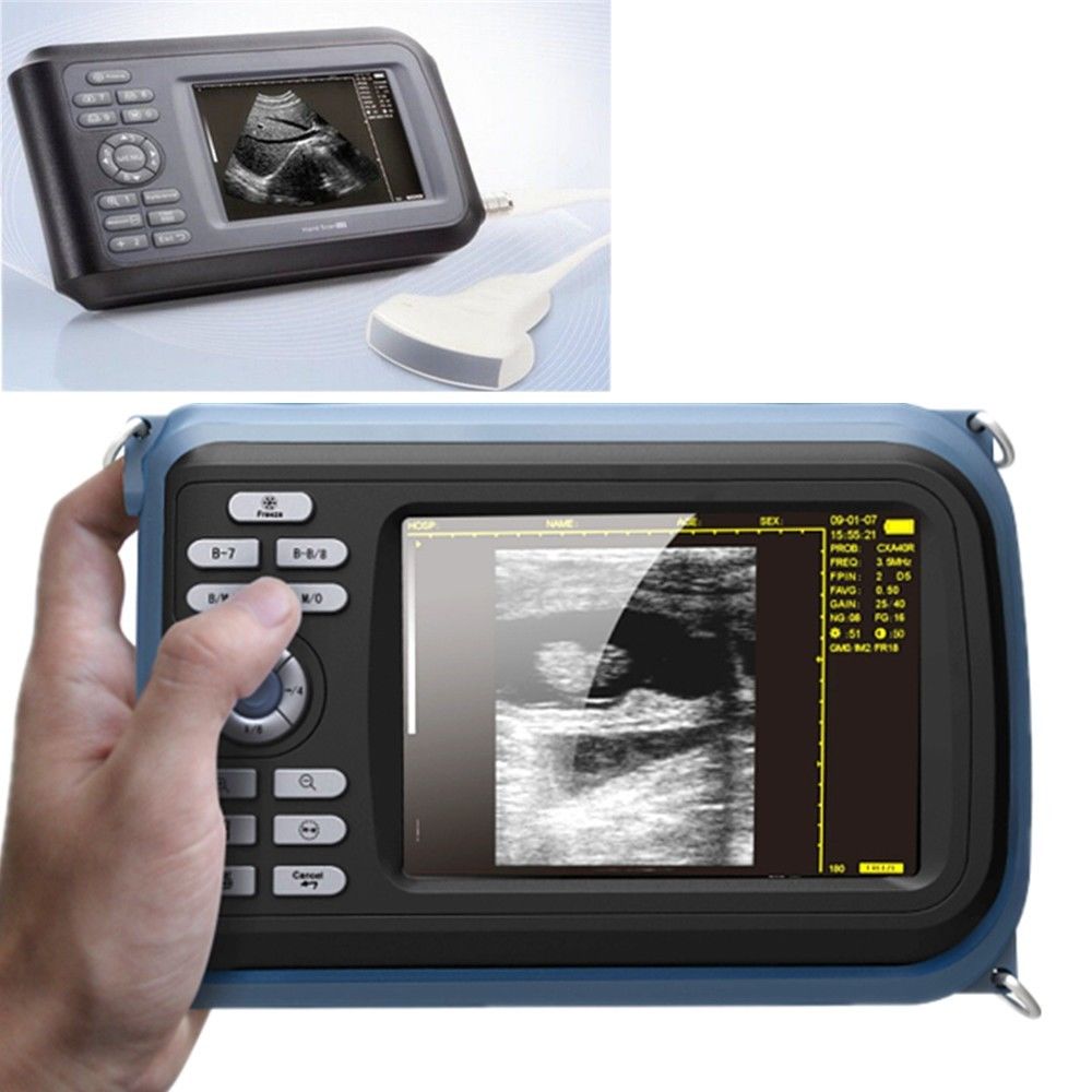 Portable laptop Machine Ultrasound Scanner Convex +Linear +Transvaginal 3 Probe DIAGNOSTIC ULTRASOUND MACHINES FOR SALE