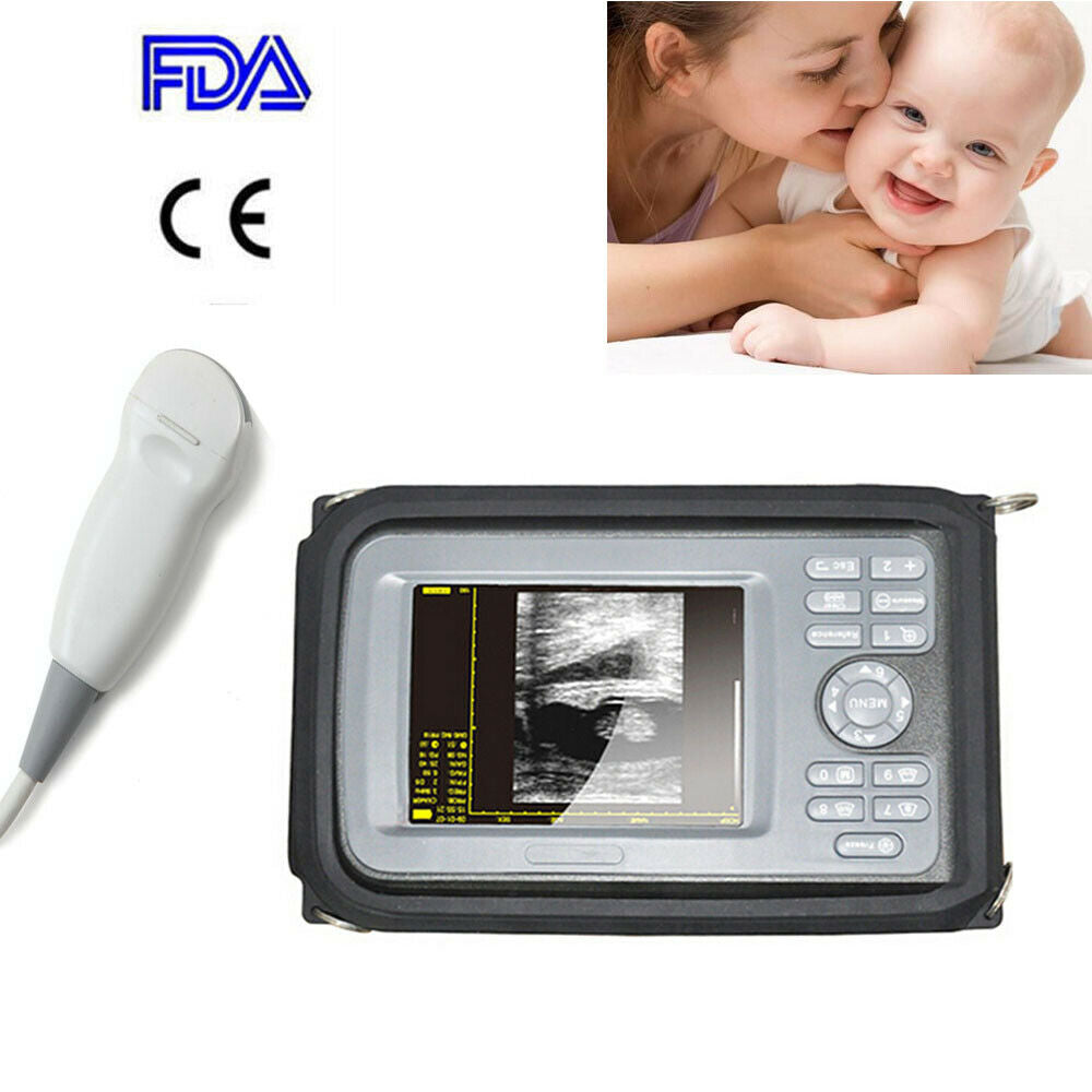 Newest Digital Handheld Ultrasound Machine Scanner+5Mhz Micro-Convex Human Use DIAGNOSTIC ULTRASOUND MACHINES FOR SALE