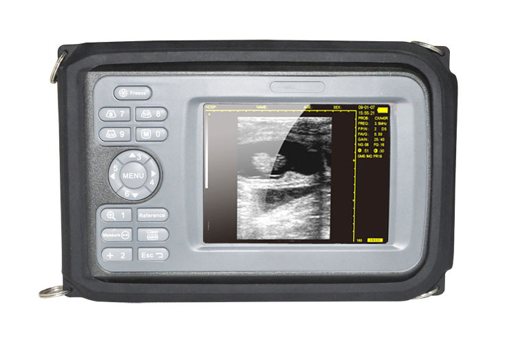 Portable 5.5 Inch Digital LCD Check Ultrasound Scanner & 7.5Mhz linear Probe CE 190891410818 DIAGNOSTIC ULTRASOUND MACHINES FOR SALE